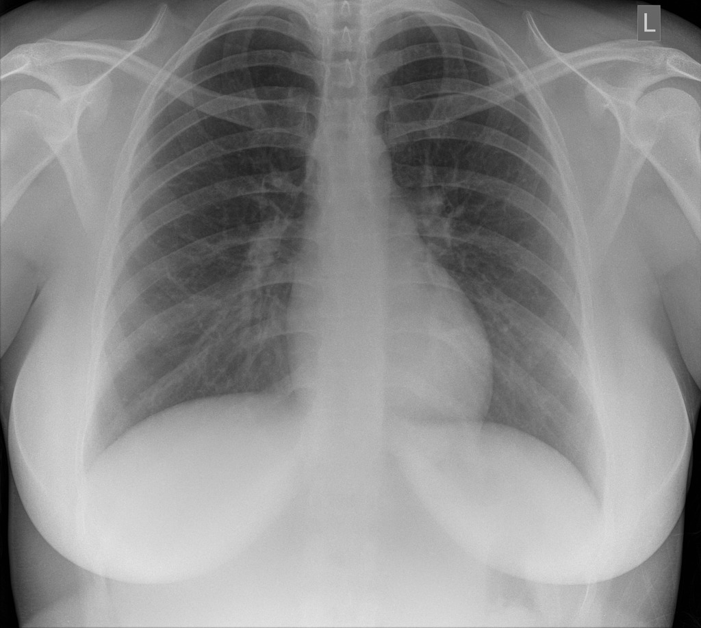 What are the different types of x-ray? - Health Service Navigator