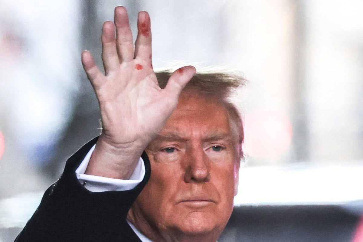 Trump's hands (3 theories) and why no medical exam since 2018